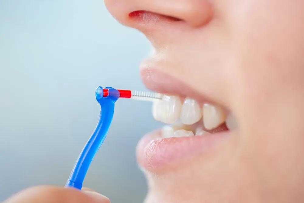Cách chính xác để sử dụng bàn chải kẽ răng